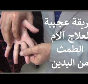 Embedded thumbnail for علاج الدورة الشهرية بأسرع وسيلة طبيعية